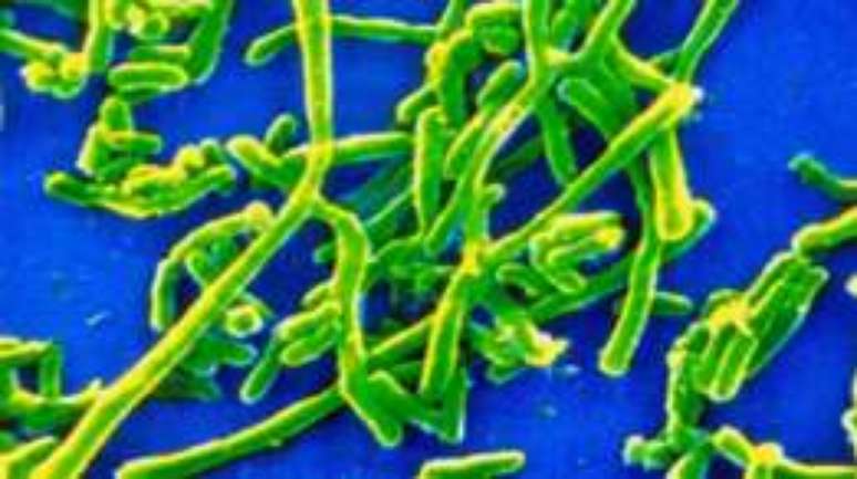 A bact&eacute;ria Corynebacterium causa a difteria, que pode ser fatal se n&atilde;o for tratada