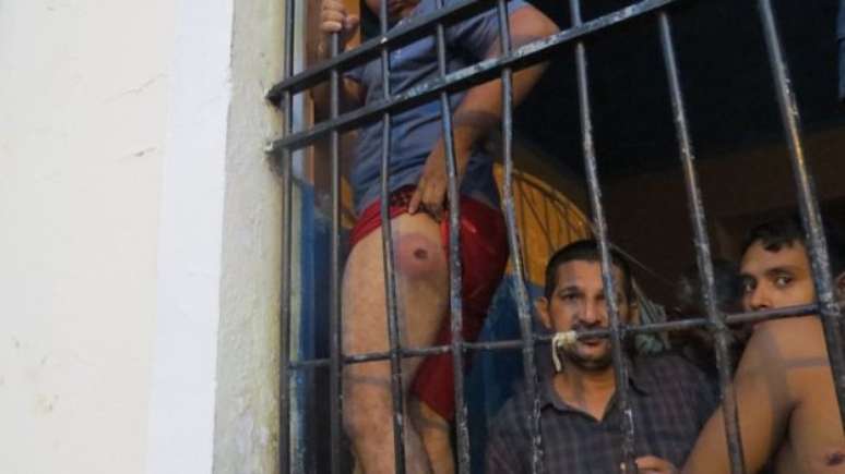 Preso mostra perna machucada durante chacina no Compaj 