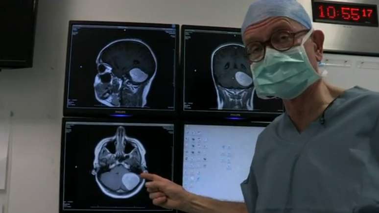 Henry Marsh mostra um scaner de um tumor cerebral "provavelmente benigno"