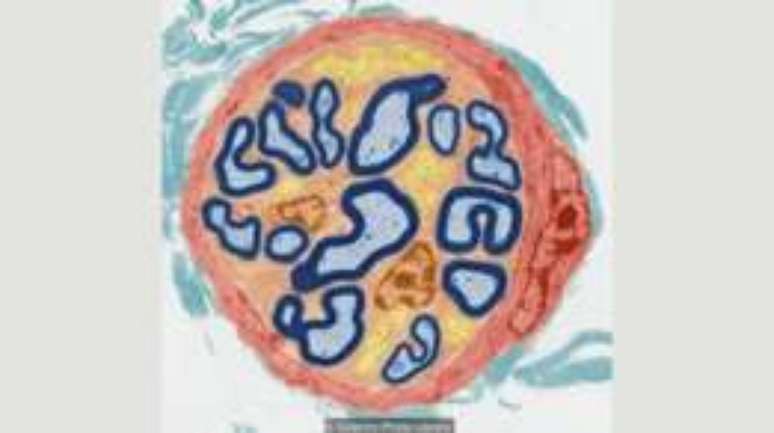 M&eacute;dicos ainda est&atilde;o tentando descobrir como as diferen&ccedil;as no sistema nervoso perif&eacute;rico pode causar esses sintomas