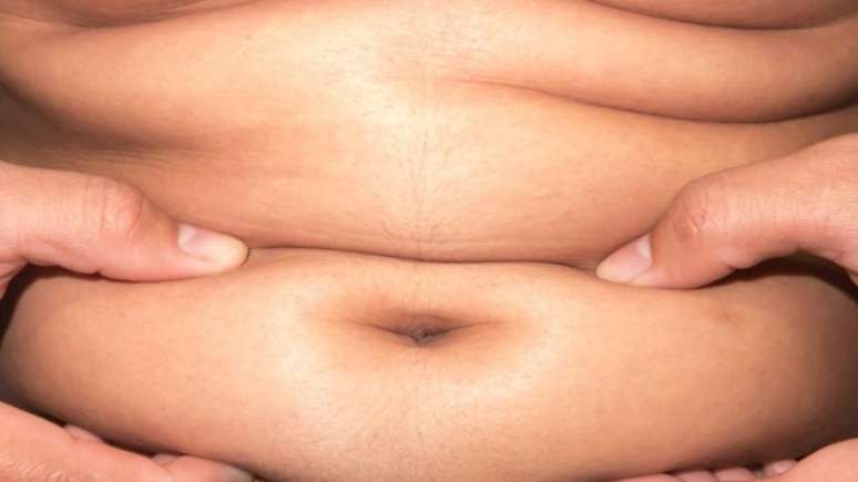 O excesso de gordura pode provocar uma série de problemas de saúde