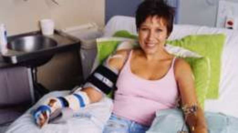 Simone passou por uma s&eacute;rie de procedimentos cir&uacute;rgicos durante cinco anos