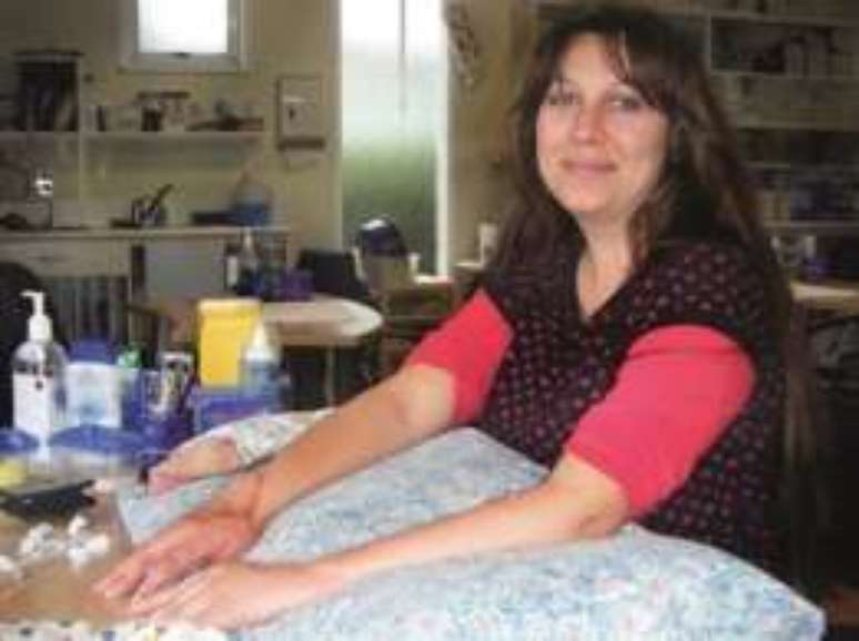 Neozelandesa conseguiu recuperar mais movimentos que m&eacute;dicos esperavam