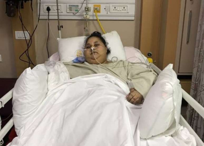 Eman Ahmed Abd El Aty, que chegou a pesar 500 quilos, recupera-se de cirurgia bariátrica em hospital na Índia