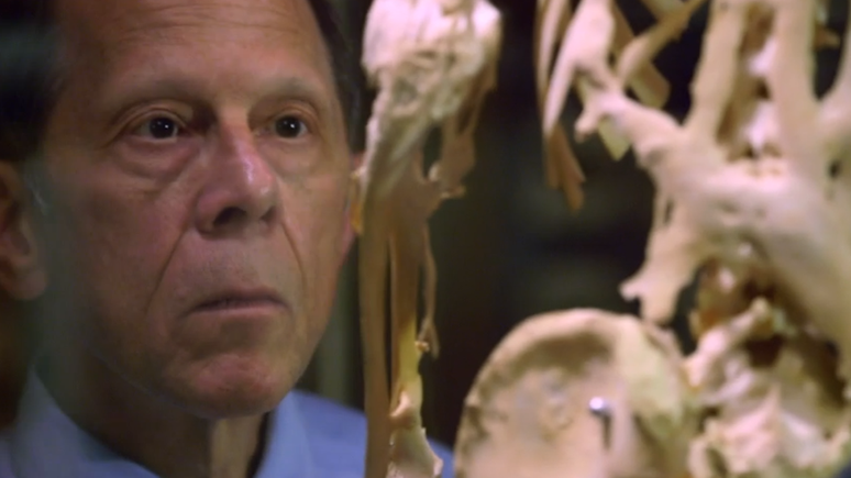 Fred Kaplan observa o esqueleto de Harry Eastlack, no museu Mutter da Filadélfia, nos EUA