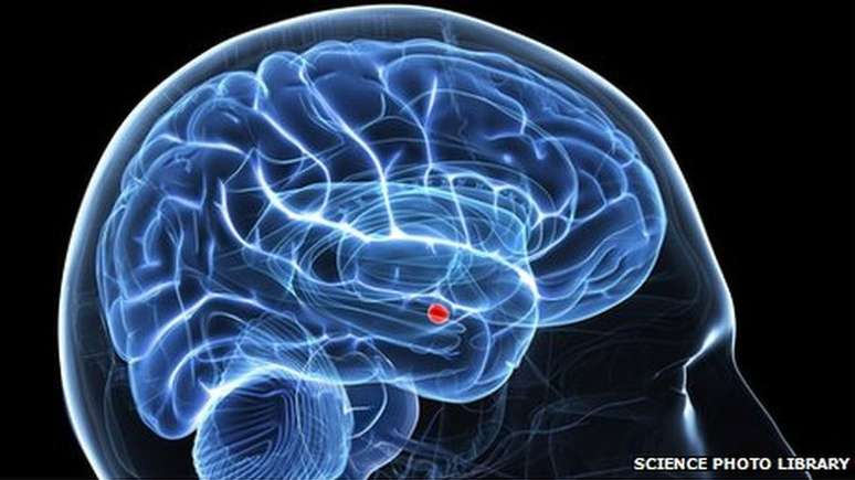 Indiv&iacute;duos com autismo possuem menos atividade na am&iacute;gdala (em vermelho), que tem um papel fundamental no processamento de emo&ccedil;&otilde;es