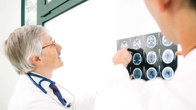 Doenças neurodegenerativas incluem Alzheimer, Parkinson, Huntington e esclerose múltipla