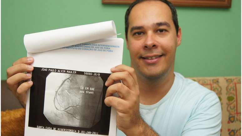 João Paulo Mauler mostra exame após coração operado; infarto foi 'divisor de águas' profissional, afirma ele