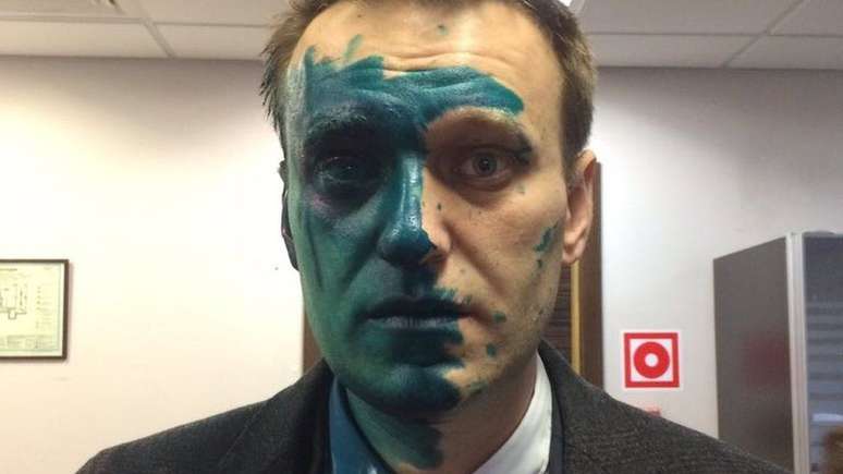 O opositor Navalny já foi atacado com o líquido duas vezes