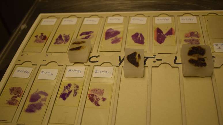 Amostras de tecido dos órgãos são preservados em blocos de parafina