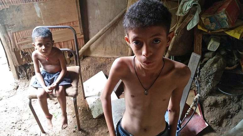 Escassez severa de alimentos e infla&ccedil;&atilde;o de 700% faz com que cada vez mais pessoas busquem comida no lixo; n&iacute;veis de desnutri&ccedil;&atilde;o s&atilde;o alarmantes, diz ONG.