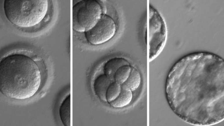 Fotos de embriões geneticamente modificados: cientistas conseguiram editar genes que causavam a cardiomiopatia hipertrófica a ser transmitida de pais para filhos 