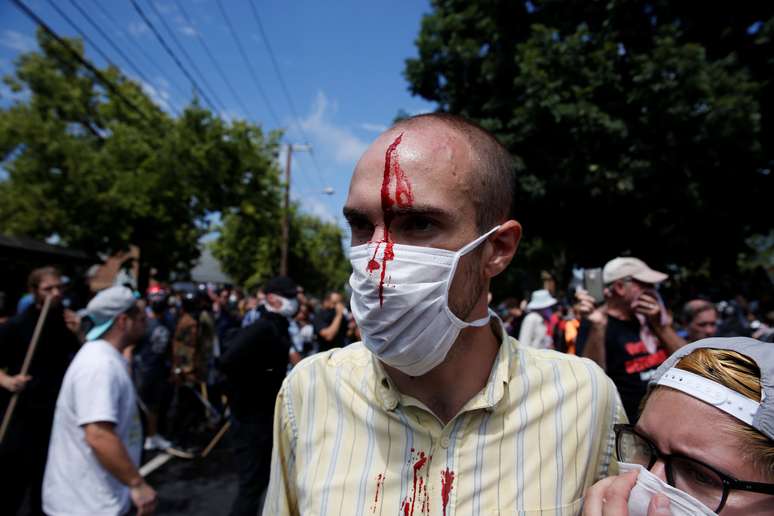 Homem ferido após confronto entre manifestantes e membros da extrema direita