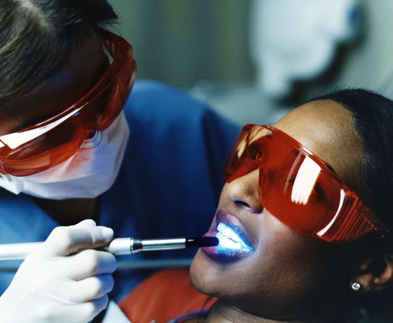 Los resultados de los tratamientos en el dentista son permanentes, pero los dientes se mancharán de nuevo