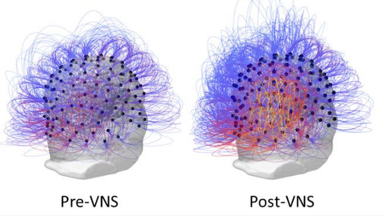 Imagens da atividade cerebral do paciente