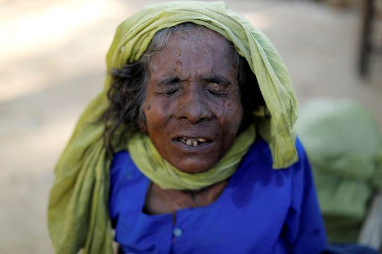 Refugiada rohingya durante checagem médica em Palang Khali, Bangladesh REUTERS/Jorge Silva