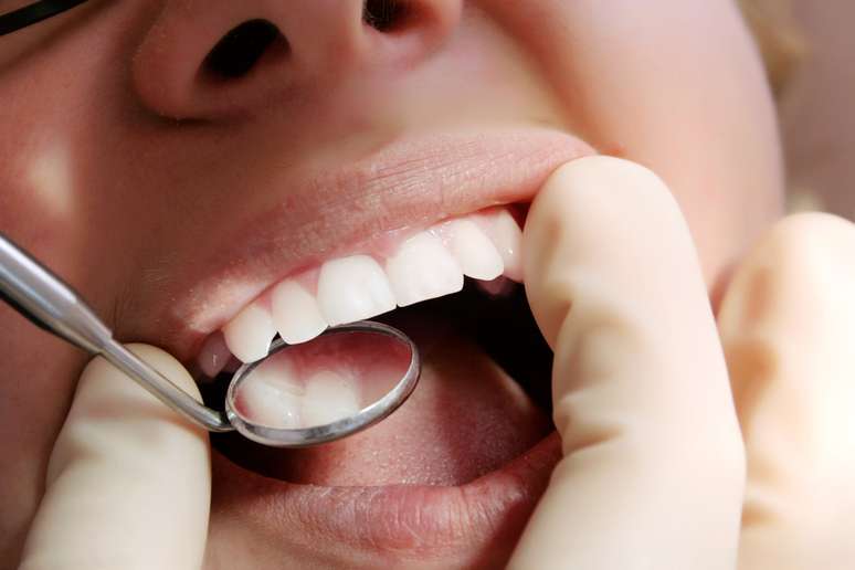 Qualquer alteração na cavidade bucal pode significar sérios problemas de saúde.