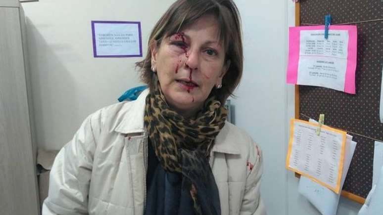 Professora Marcia Friggi após agressão em sala de aula; caso abriu debate nacional sobre violência no ambiente escolar (Foto: Reprodução/Facebook) 