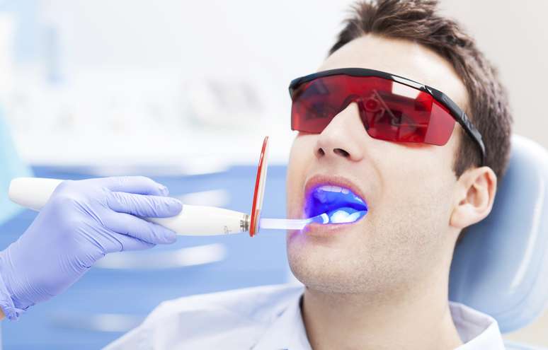 El dentista debe comparar el color natural de los dientes de una persona con el color correspondiente en una guía