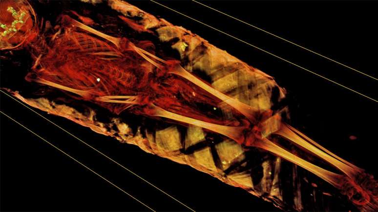 Tomografia computadorizada mostra detalhes da múmia, mas pesquisadores querem ir além | Foto: Northwestern University