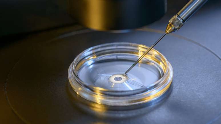 Casal tenta a primeira seleção de embriões feita no Brasil para a neutropenia causada pela mutação do gene VPS45A