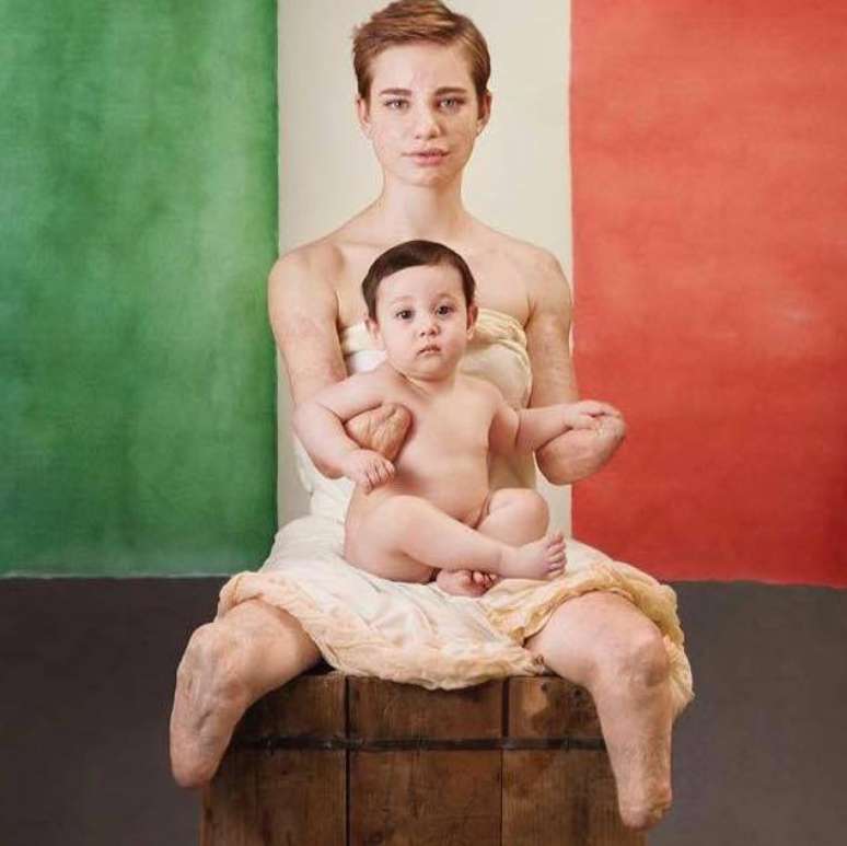 Bebe Vio: 'Divirto-me conhecendo gente feliz e tentando contribuir para a felicidade de outras pessoas' | Foto: Anne Geddes