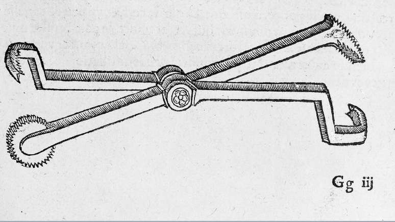 Ilustração de um pelicano dental, no livro 'As obras de Ambroise Pare', de 1585 | Foto: Wellcome Library