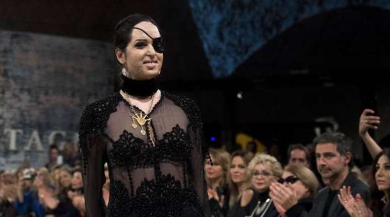 Miss italiana atacada com ácido participa de desfile de moda