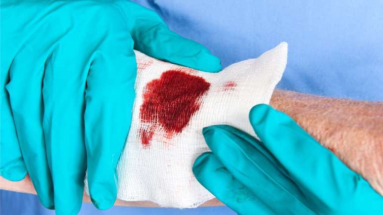 'Se houver sangramento no corte, a primeira coisa &eacute; estancar esse sangue, fazendo um curativo simples para isso', disse o tenente