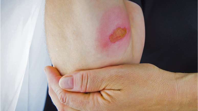 'Nada de pasta de dente, carne. S&oacute; &aacute;gua na temperatura ambiente', refor&ccedil;a o tenente