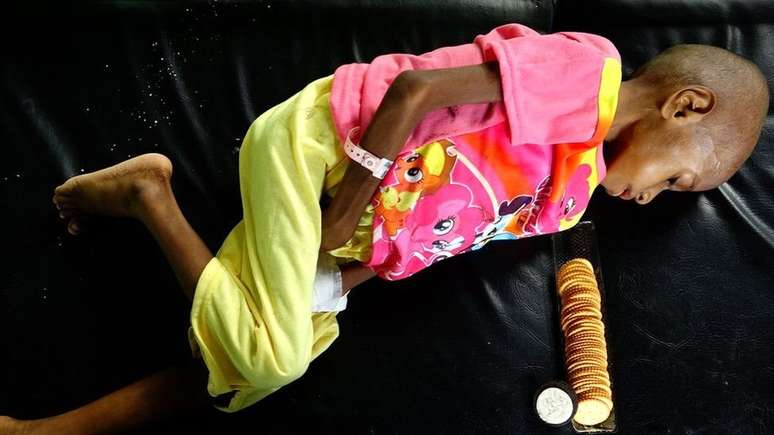 Tr&ecirc;s filhos de Ofnea Yohanna est&atilde;o desnutridos; 'N&oacute;s comemos quando tem alguma comida, quando n&atilde;o tem, n&atilde;o comemos. N&oacute;s n&atilde;o temos um barco agora para pescar', diz