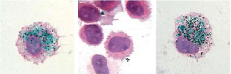 Pigmento verde de uma tatuagem é visto dentro de um macrófago; no centro, o pigmento a liberado após a morte de uma célula; à direita, 90 dias depois, a tinta é recuperada por uma nova célula | Imagem: Baranska et al., 2018