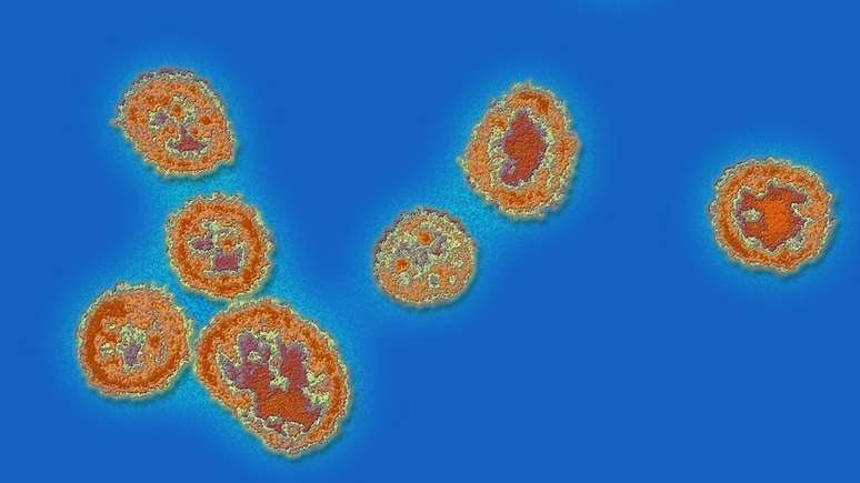 A Febre de Lassa é uma doença hemorrágica viral