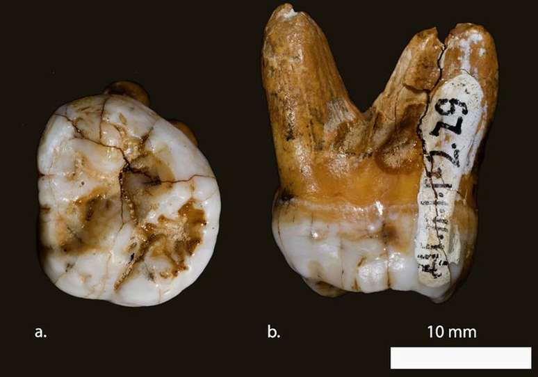 Este dente é um dos poucos restos fósseis de Denisovanos encontrados até agora | Foto: David Reich/Nature