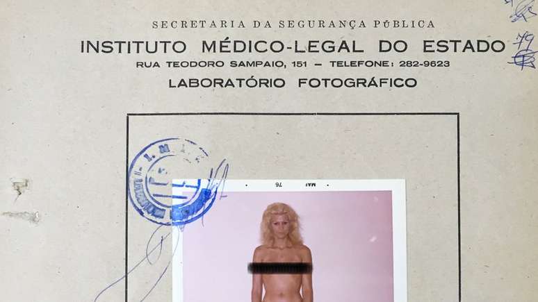 Fotografia de Waldirene em laudo do IML, feita em 1976; ela teve negado o pedido do habeas corpus preventivo para não ser submetida ao exame (a marca protegendo os seios foi feita pela BBC Brasil)