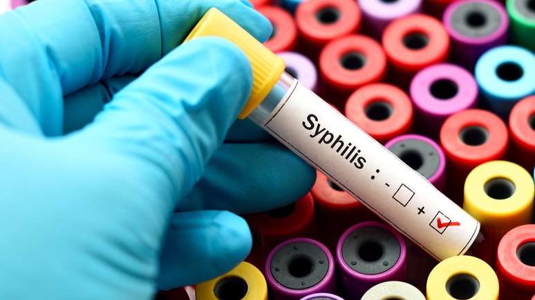 OMS calcula que haja no mundo, anualmente, 5,6 milhões de infecções por sífilis; aumento no Brasil foi de quase 30% entre 2015 e 2016