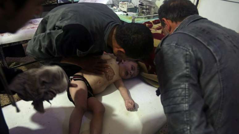 Criança é tratada em hospital em Douma, no leste de Ghouta, na Síria, após suspeita de ataque químico