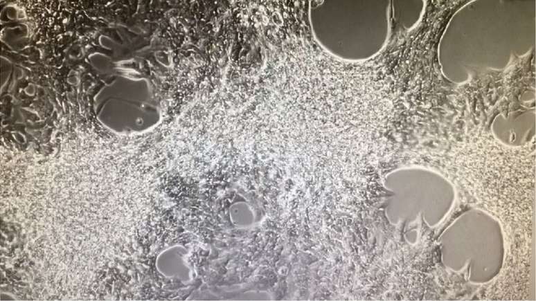 C&eacute;lulas do curativo card&iacute;aco visualizadas de perto | Foto: Reprodu&ccedil;&atilde;o de v&iacute;deo da Universidade de Stanford