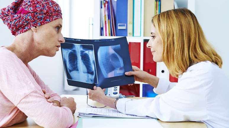 O resultado se aplica apenas a pacientes nos estágios iniciais de câncer