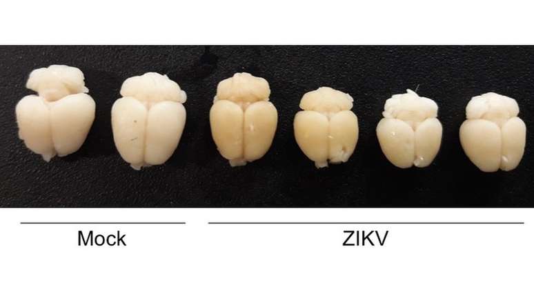 Cérebros de camundongos foram estudados após a infecção por zika