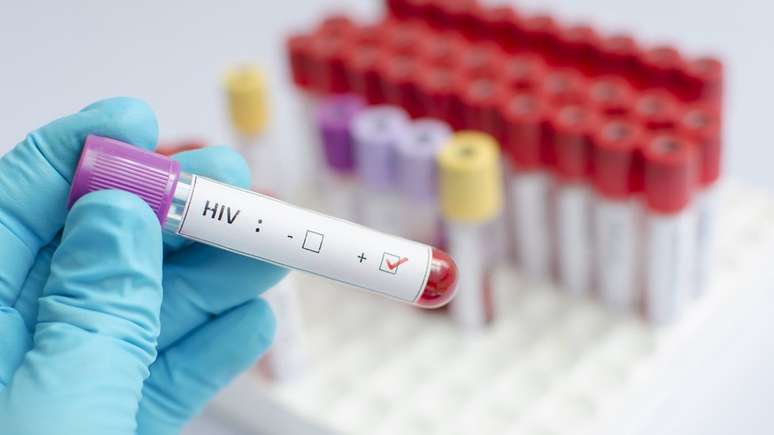 Segundo estudo publicado na revista acadêmica The Lancet, a vacina preventiva para HIV deu 67% de proteção contra o vírus