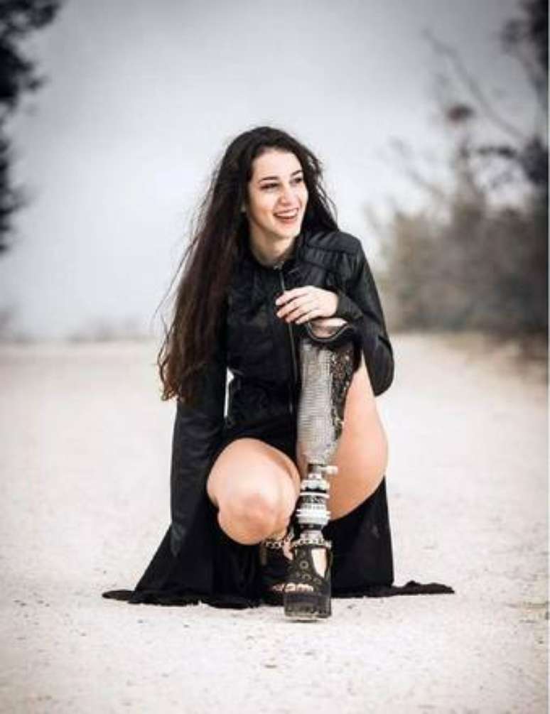 Chiara Bondi, 17 anos, desfilará no concurso com prótese no Miss Itália