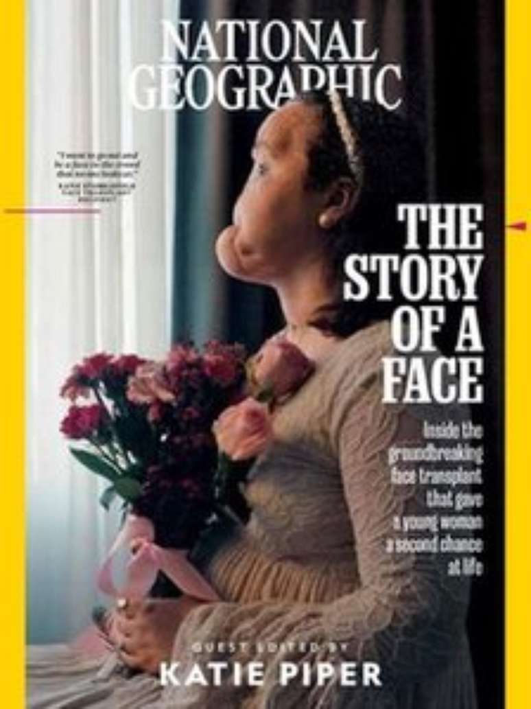 A reportagem que conta a história de Katie é capa da edição de setembro da revista National Geographic. A foto mostra o rosto da americana ainda antes de passar pelo transplante