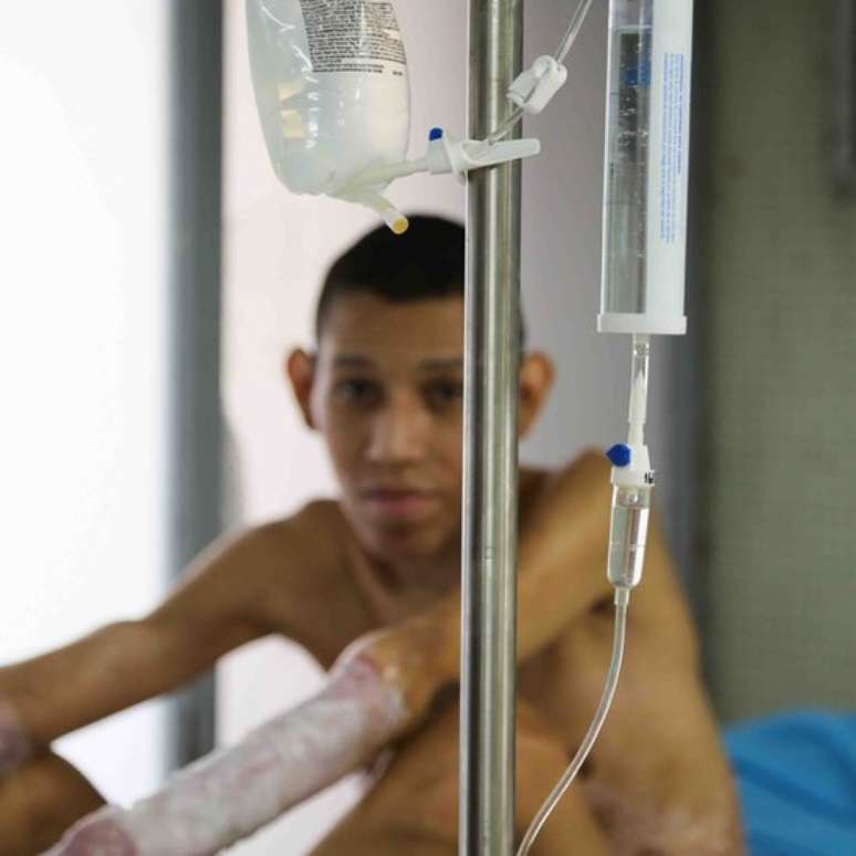 &Aacute;ngel sofreu queimaduras h&aacute; 5 anos. Na Venezuela, em vez de tratamento no hospital, ele contraiu infec&ccedil;&otilde;es. Agora, est&aacute; sendo tratado na Col&ocirc;mbia