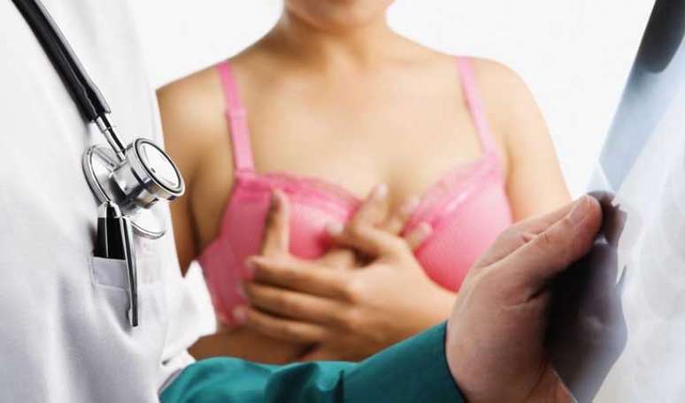 48. C&Acirc;NCER DE MAMA: uma pesquisa recente publicada na revista Cancer, da Sociedade Americana para o C&acirc;ncer, mostrou uma redu&ccedil;&atilde;o de at&eacute; 30% no risco dessa doen&ccedil;a em mulheres que praticavam atividades f&iacute;sicas recreacionais 