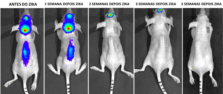 Vírus que causou pânico entre grávidas brasileiras pelo risco de microcefalia pode se tornar aliado contra câncer no cérebro | Crédito: CEGH-CEL