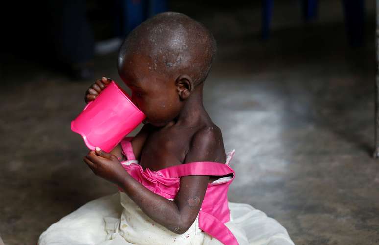 Criança desnutrida na República Democrática do Congo 15/03/2018 REUTERS/Thomas Mukoya 