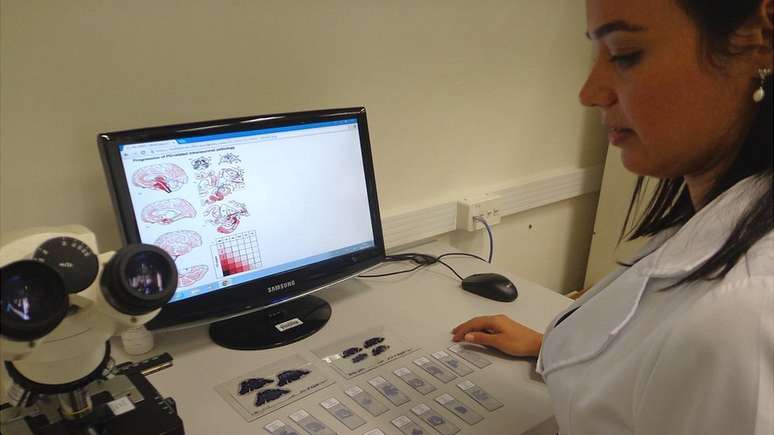 Pesquisas mostraram aos cientistas que Mal de Alzheimer come&ccedil;a a matar neur&ocirc;nios em partes do enc&eacute;falo diferentes do que se imaginava