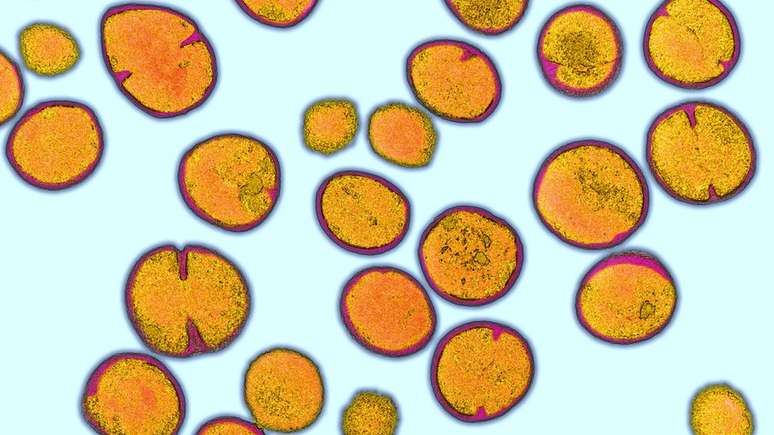 Nos banheiros com secadores a jatos de ar, havia três vezes mais Staphylococcus aureus resistente à meticilina (SARM)