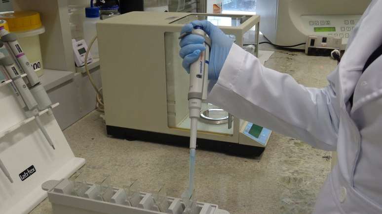 Cientistas est&atilde;o analisando c&eacute;rebros humanos para tentar identificar altera&ccedil;&otilde;es em &aacute;reas onde o Alzheimer aparece primeiro no c&eacute;rebro